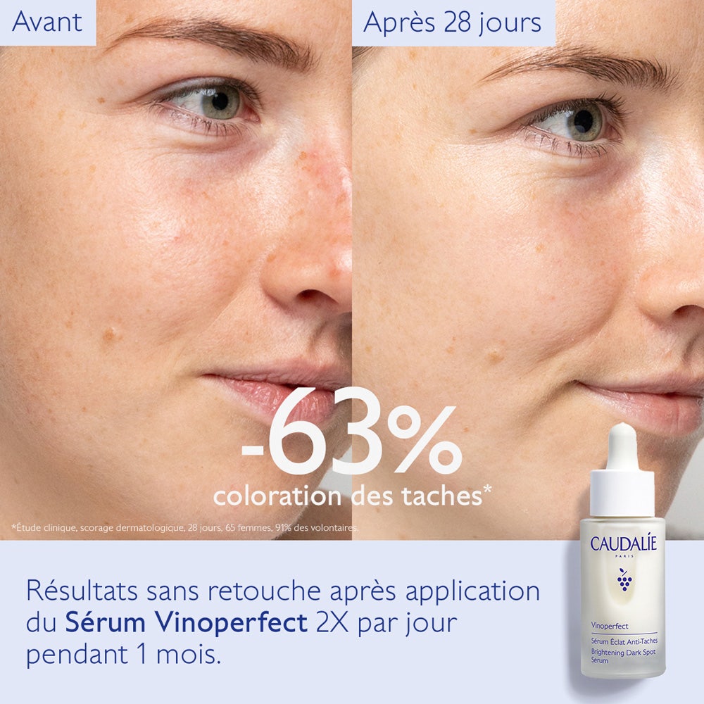 コーダリー　CAUDALIE Vinoperfect 30ml Caudalie Vinoperfect Brightening Dark Spot Serum 1 oz30 ml